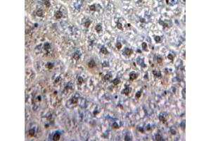 IHC-P analysis of Liver tissue, with DAB staining. (MYB anticorps  (AA 35-291))