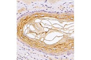 Immunohistochemistry of paraffin embedded rat esophagus using TR2IT1 (ABIN7075887) at dilution of 1:1500 (400x lens) (TXNRD3NB anticorps)