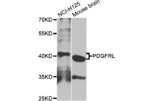 Western blot analysis of extracts of NCI-H125 cells, using PDGFRL antibody (ABIN5995942) at 1/1000 dilution. (PDGFRL anticorps)