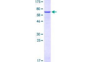 Image no. 1 for Epiphycan (EPYC) (AA 20-322) protein (GST tag) (ABIN1352997)