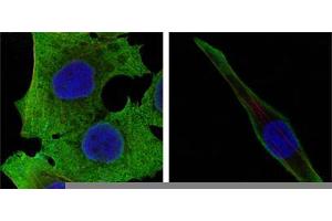 Confocal immunofluorescence analysis of PANC-1 (left) and SKBR-3 (right) cells using SOD1 mouse mAb (green). (SOD1 anticorps)