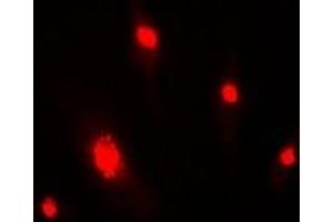 Immunofluorescent analysis of DDB2 staining in MCF7 cells. (DDB2 anticorps)