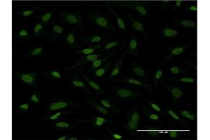 Immunofluorescence of monoclonal antibody to CDC2L6 on HeLa cell. (CDK19 anticorps  (AA 1-114))