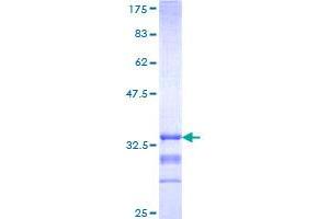 Image no. 1 for Melanocortin 3 Receptor (MC3R) (AA 1-74) protein (GST tag) (ABIN1310510)