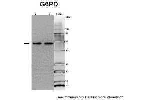 Sample type: 1. (Glucose-6-Phosphate Dehydrogenase anticorps  (Middle Region))