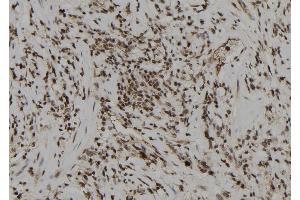 ABIN6274008 at 1/100 staining Human gastric tissue by IHC-P. (DUSP6 anticorps  (Internal Region))