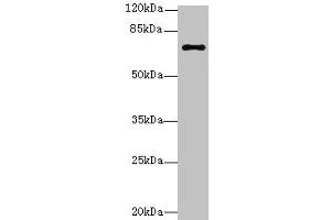 Western blot All lanes: RHOBTB3 antibody at 12 μg/mL + Hela whole cell lysate Secondary Goat polyclonal to rabbit IgG at 1/10000 dilution Predicted band size: 70 kDa Observed band size: 70 kDa (RHOBTB3 anticorps  (AA 251-500))