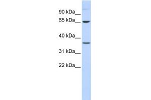 WB Suggested Anti-EPN2 Antibody Titration: 0.