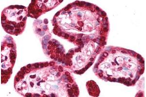 anti-Tripartite Motif Containing 34 (TRIM34) (AA 49-98) antibody