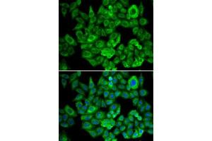 Immunofluorescence analysis of U2OS cells using OGDH antibody (ABIN6131414, ABIN6145003, ABIN6145005 and ABIN6222018).