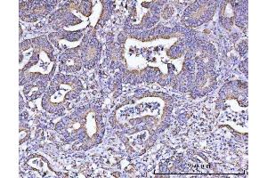 IHC analysis of ATP5F1B using anti-ATP5F1B antibody (ABIN7599866). (Atp5f1b (AA 123-529) anticorps)