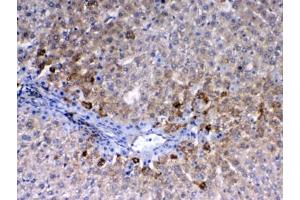 IHC testing of FFPE rat liver tissue with CD105 antibody at 1ug/ml. (Endoglin anticorps)