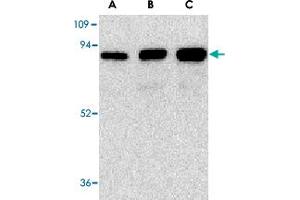 Western blot analysis of (A) 25 ng, (B) 50 ng, and (C) 100 ng of purified recombinant NGFR with NGFR polyclonal antibody  at 1 ug/mL . (NGFR anticorps)