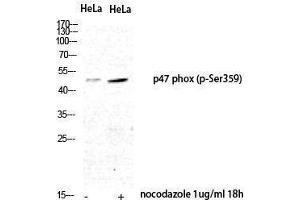 Western Blotting (WB) image for anti-Neutrophil Cytosol Factor 1 (NCF1) (pSer359) antibody (ABIN3182821) (NCF1 anticorps  (pSer359))