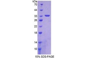 SDS-PAGE of Protein Standard from the Kit (Highly purified E.