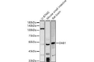 Western blot analysis of extracts of various cell lines, using D antibody (ABIN6130320, ABIN6139385, ABIN6139386 and ABIN6214572) at 1:500 dilution. (DAB1 anticorps  (AA 1-185))