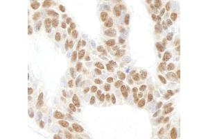 anti-Ribosomal Protein L26 (RPL26) (C-Term) antibody