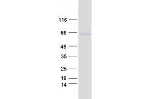Validation with Western Blot
