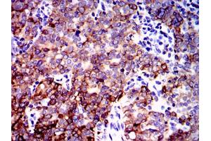 Immunohistochemistry (IHC) image for anti-Protein Phosphatase 2A Activator, Regulatory Subunit 4 (PPP2R4) antibody (ABIN1108715)