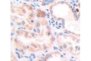 Figure. (alpha Taxilin anticorps  (AA 328-531))