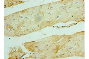 Immunohistochemistry of paraffin-embedded human skeletal muscle tissue using ABIN7175850 at dilution of 1:100 (WISP2 anticorps  (AA 1-250))