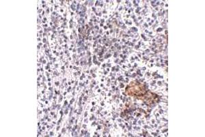 Immunohistochemistry (IHC) image for anti-Leucine-rich repeat protein SHOC-2 (SHOC2) (N-Term) antibody (ABIN1031560) (SHoc2/Sur8 anticorps  (N-Term))