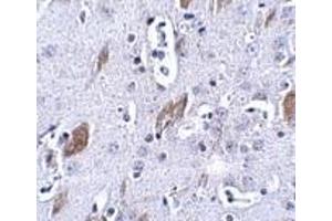Immunohistochemistry of ATOH8 in mouse brain tissue with this product atOH8 antibody at 5 μg/ml.