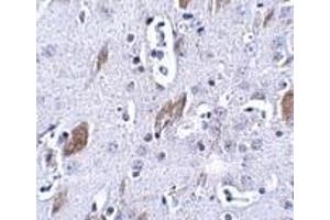 Immunohistochemistry of ATOH8 in mouse brain tissue with this product atOH8 antibody at 5 μg/ml. (ATOH8 anticorps  (C-Term))