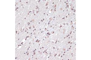 Immunohistochemistry of paraffin-embedded rat brain using c-Jun antibody (ABIN6131074, ABIN6142670, ABIN6142671 and ABIN6215187) at dilution of 1:100 (40x lens).