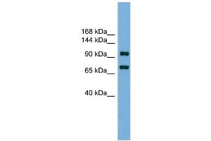 WB Suggested Anti-Ttf1 Antibody Titration: 0. (TTF1 anticorps  (N-Term))