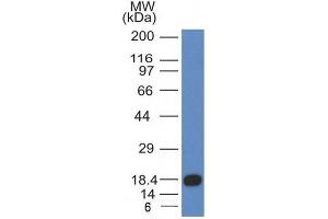 Image no. 1 for anti-Mast/stem Cell Growth Factor Receptor (KIT) (AA 100-300) antibody (ABIN6190789) (KIT anticorps  (AA 100-300))