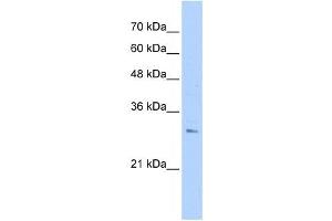 RHBDL2 antibody used at 1 ug/ml to detect target protein.