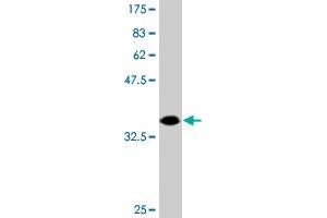 Western Blot detection against Immunogen (47. (DIP2A anticorps  (AA 107-301))