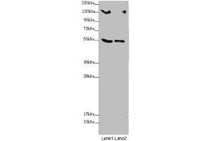 Western blot All lanes: CSPP1 antibody at 1. (CSPP1 anticorps  (AA 997-1256))