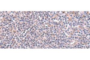 Immunohistochemistry of paraffin-embedded Human tonsil tissue using GMDS Polyclonal Antibody at dilution of 1:70(x200)