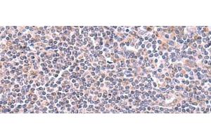 Immunohistochemistry of paraffin-embedded Human tonsil tissue using GMDS Polyclonal Antibody at dilution of 1:70(x200) (GMDS anticorps)