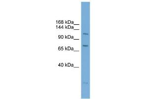 WB Suggested Anti-PAntibody Titration:  0. (PARP10 anticorps  (N-Term))