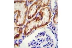 anti-Glycine Amidinotransferase (GATM) (N-Term) antibody