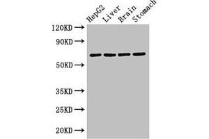 Western Blot Positive WB detected in: HepG2 whole cell lysate, Rat liver tissue, Rat brain tissue, Rat stomach tissue All lanes: RCBTB2 antibody at 3. (RCBTB2 anticorps  (AA 1-200))