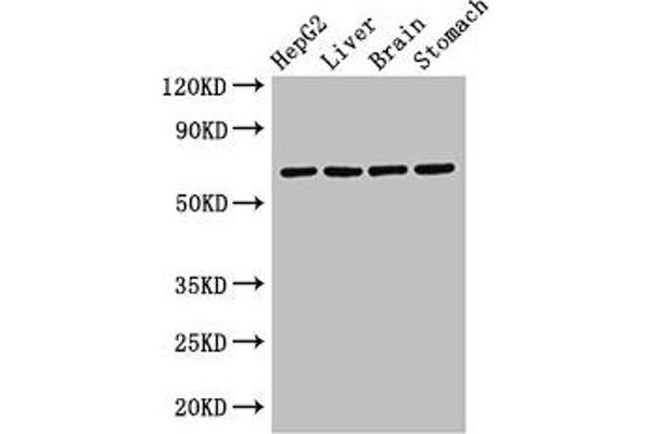 RCBTB2 anticorps  (AA 1-200)
