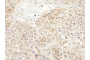 Immunohistochemistry (IHC) image for anti-Parkinson Protein 7 (PARK7) (C-Term) antibody (ABIN7448532) (PARK7/DJ1 anticorps  (C-Term))