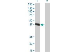 Western Blot analysis of HLF expression in transfected 293T cell line by HLF monoclonal antibody (M03), clone M1. (HLF anticorps  (AA 1-295))