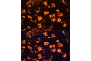 Immunofluorescence analysis of C6 cells using J antibody (ABIN7268035) at dilution of 1:100.