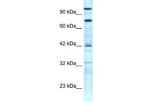 WB Suggested Anti-ZNF23 Antibody Titration:  0. (ZNF23 anticorps  (N-Term))