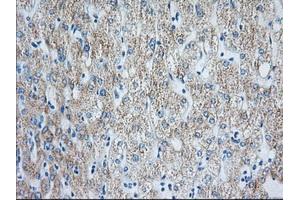 Immunohistochemical staining of paraffin-embedded Human liver tissue using anti-HIBCH mouse monoclonal antibody. (HIBCH anticorps)
