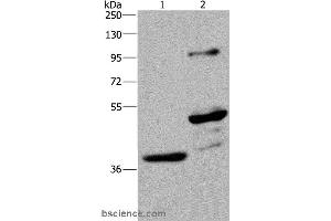 Western blot analysis of Human fetal brain and mouse brain tissue, using GAS7 Polyclonal Antibody at dilution of 1:625