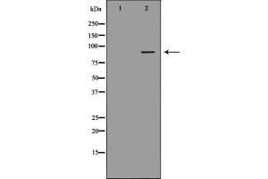 Western blot analysis of extracts from Jurkat cells, using DVL2 antibody. (DVL2 anticorps  (C-Term))