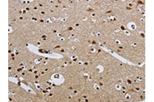 The image on the left is immunohistochemistry of paraffin-embedded Human brain tissue using ABIN7190315(CMTM8 Antibody) at dilution 1/40, on the right is treated with synthetic peptide. (CMTM8 anticorps)