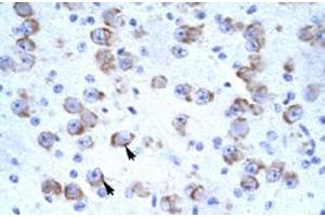 Immunohistochemical staining (Formalin-fixed paraffin-embedded sections) of human brain with CATSPER2 polyclonal antibody  at 4-8 ug/mL working concentration. (CATSPER2 anticorps  (N-Term))