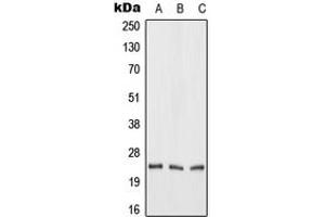 Western blot analysis of FGF19 expression in HeLa (A), mouse liver (B), rat liver (C) whole cell lysates. (FGF19 anticorps  (Center))